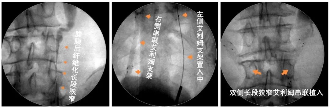 ������ʱ - �������ǲ�!